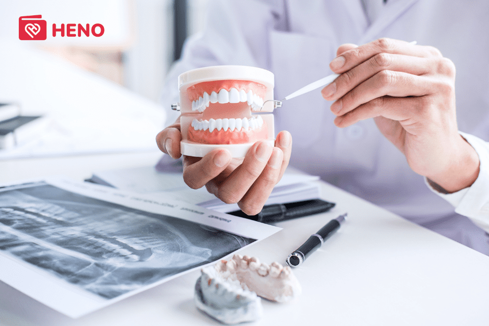 Trồng răng giả bằng cách nào thì tốt: Cầu răng sứ hay cấy ghép Implant